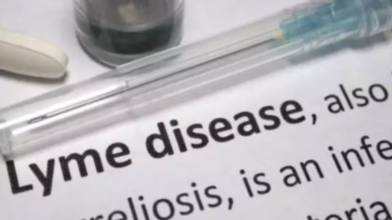 എറണാകുളത്ത് അപൂർവരോഗം റിപ്പോർട്ട് ചെയ്തു, ലൈം രോഗത്തിന്‍റെ ഈ ലക്ഷണങ്ങളെ അറിഞ്ഞിരിക്കാം... 