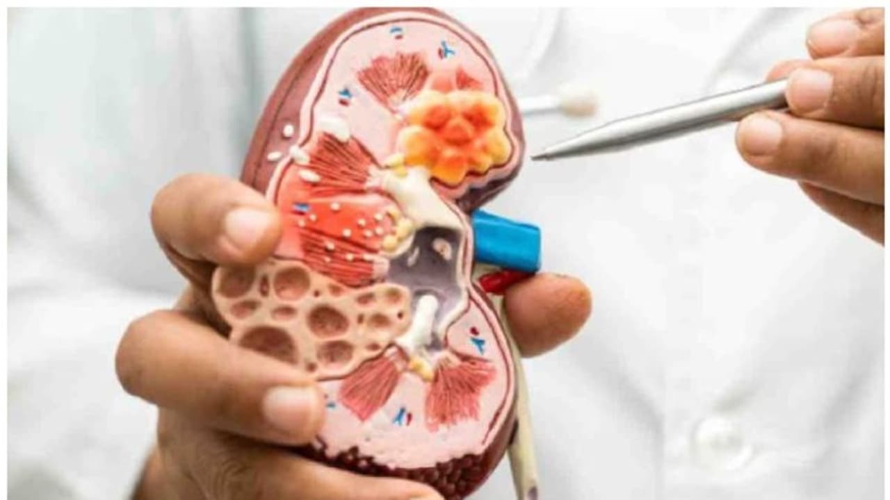 World Kidney Day 2024 : വൃക്കതകരാർ ; ഈ 9 ലക്ഷണങ്ങൾ അ​വ​ഗണിക്കരുത് 
