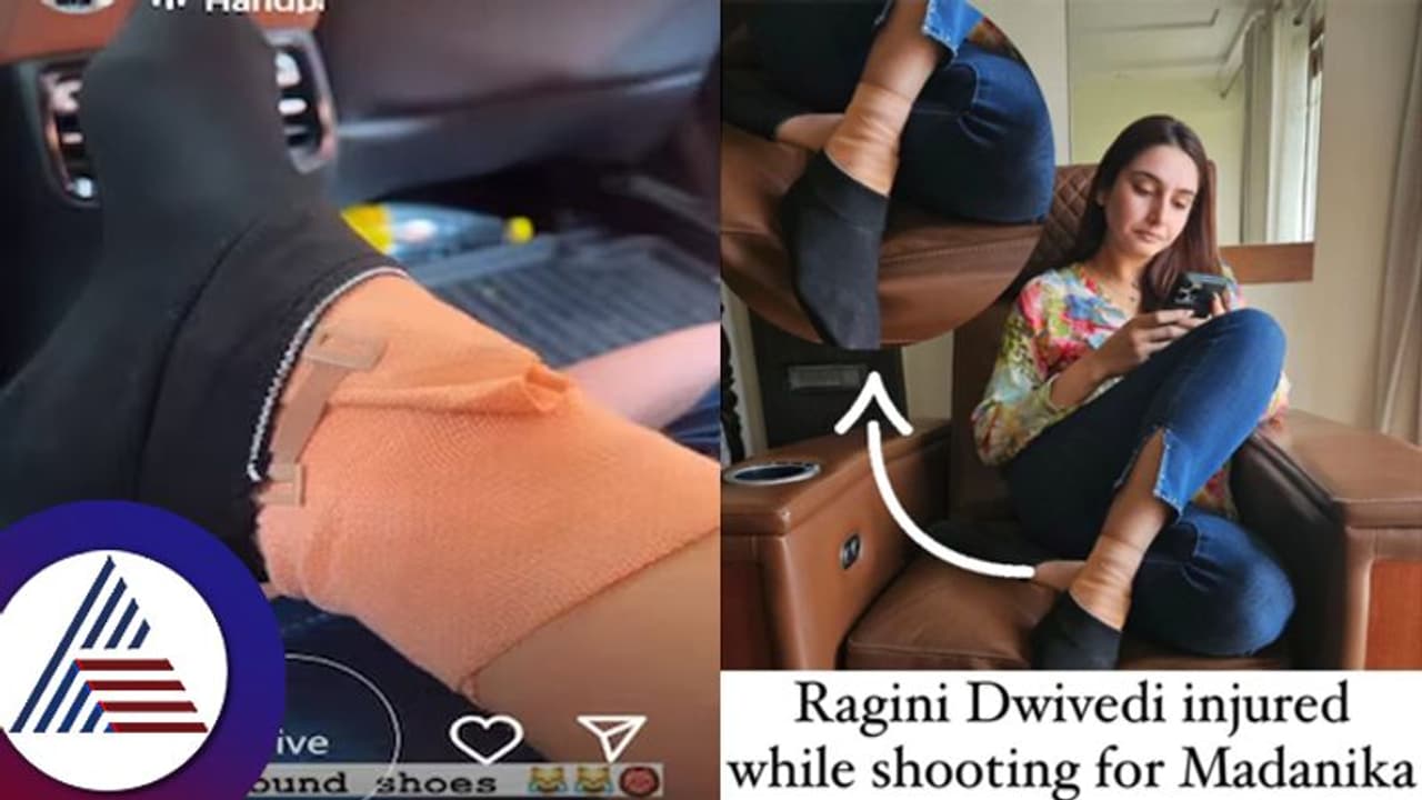 ಶೂಟಿಂಗ್ ವೇಳೆ ಭಾರಿ ಅವಘಡ: ತುಪ್ಪದ ಬೆಡಗಿ ರಾಗಿಣಿ ಕಾಲಿಗೆ ಏಟು ಚಿತ್ರೀಕರಣ ಕ್ಯಾನ್ಸಲ್ ಶೂಟಿಂಗ್ ವೇಳೆ ಭಾರಿ ಅವಘಡ: ತುಪ್ಪದ ಬೆಡಗಿ ರಾಗಿಣಿ ಕಾಲಿಗೆ ಏಟು ಚಿತ್ರೀಕರಣ ಕ್ಯಾನ್ಸಲ್