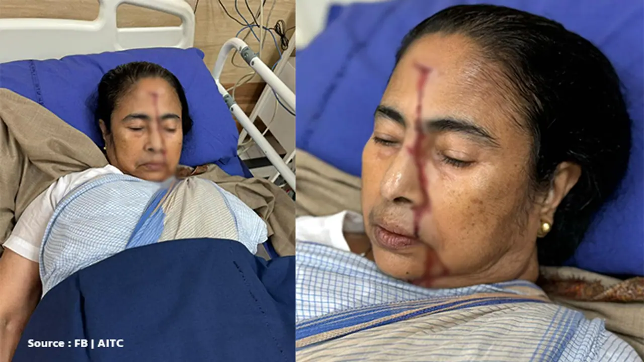 West Bengal CM Mamata Banerjee sustains 'major injury' on forehead, hospitalised West Bengal CM Mamata Banerjee sustains 'major injury' on forehead, hospitalised