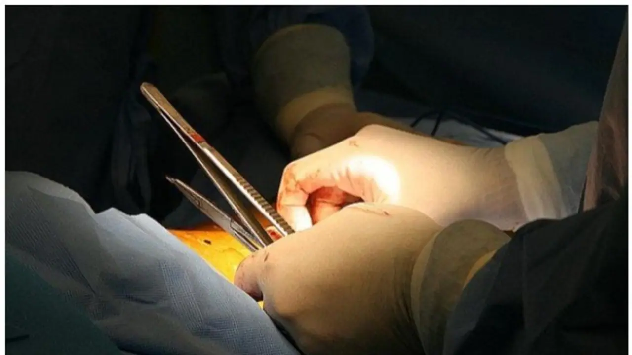 നിർണായക ശസ്ത്രക്രിയ, മനുഷ്യരാശിക്ക് നേട്ടമാകുമോ; ജനിതകമാറ്റം വരുത്തിയ പന്നിവൃക്ക മനുഷ്യനിൽ മാറ്റിവെച്ചു