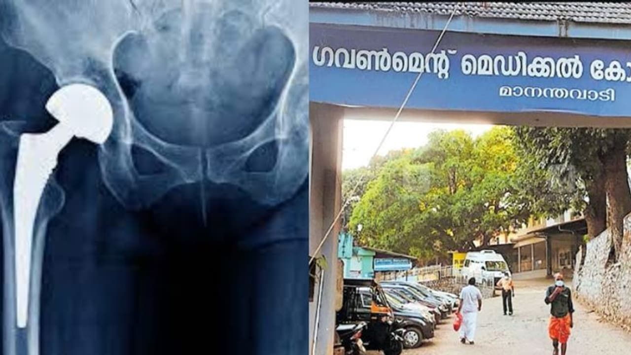 35കാരിക്ക് ഇടുപ്പിൽ വേദന, വയനാട് മെഡിക്കല് കോളേജിലെത്തി, പരിശോധനയിൽ ഗുരുതരമെന്ന് കണ്ടെത്തൽ; ശസ്ത്രക്രിയ വിജയം 35കാരിക്ക് ഇടുപ്പിൽ വേദന, വയനാട് മെഡിക്കല് കോളേജിലെത്തി, പരിശോധനയിൽ ഗുരുതരമെന്ന് കണ്ടെത്തൽ; ശസ്ത്രക്രിയ വിജയം