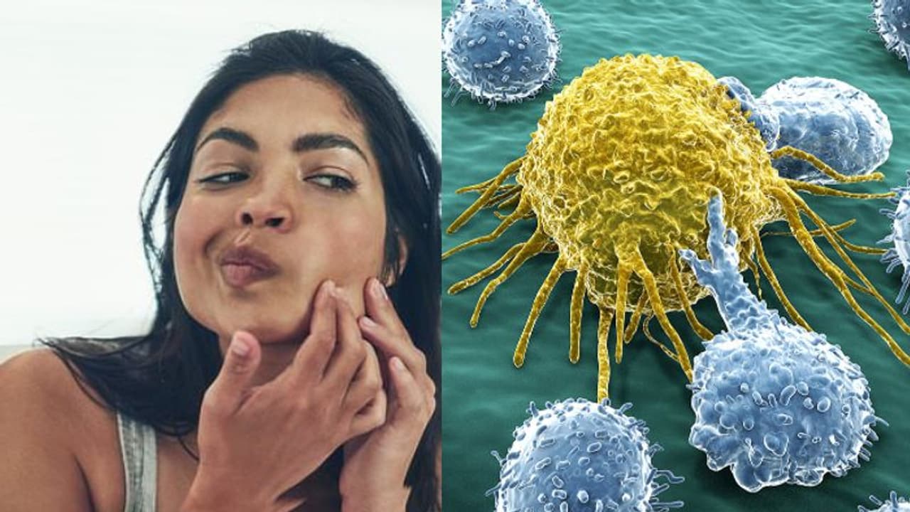 ശ്രദ്ധിക്കൂ, ഈ വൈറൽ ബ്യൂട്ടി ടിപ്പുകൾ സ്കിന് ക്യാന്സറിന് കാരണമാകും... ശ്രദ്ധിക്കൂ, ഈ വൈറൽ ബ്യൂട്ടി ടിപ്പുകൾ സ്കിന് ക്യാന്സറിന് കാരണമാകും...