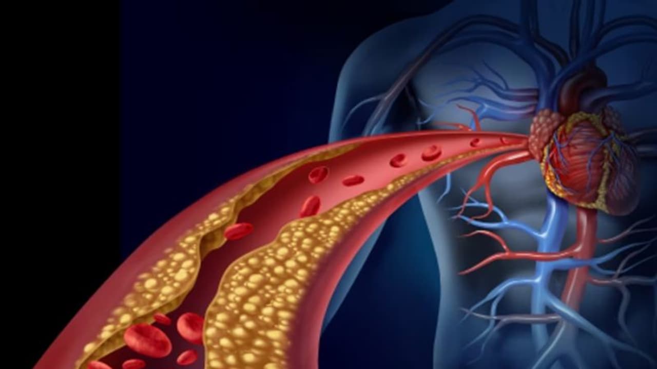 ഉയർന്ന കൊളസ്ട്രോൾ, ധമനികളിലെ തടസ്സം എന്നിവ ഒഴിവാക്കാന്‍ കഴിക്കാം ഈ പത്ത് ഭക്ഷണങ്ങള്‍... 