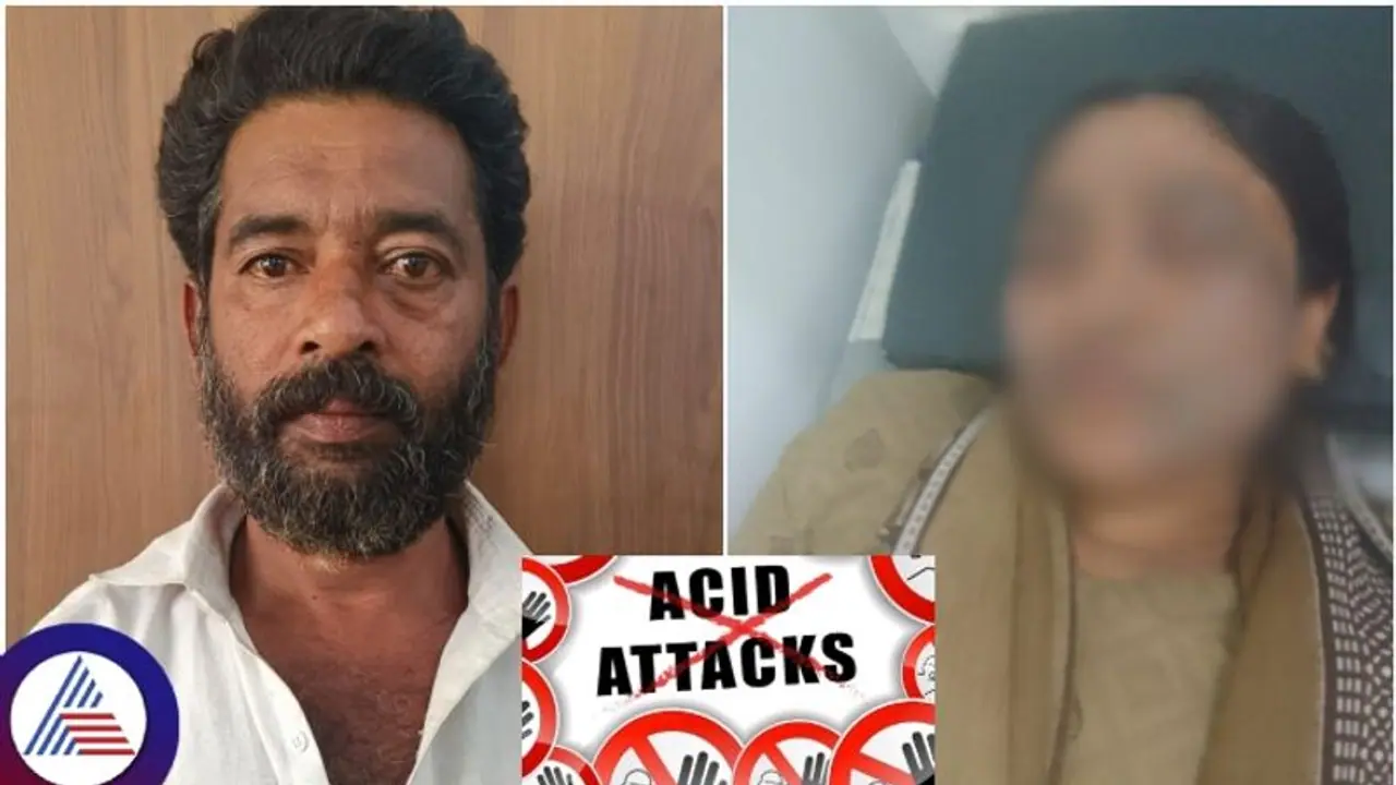 Bengaluru shocker: Husband throws acid on wife allegedly over marital dispute; check details Bengaluru shocker: Husband throws acid on wife allegedly over marital dispute; check details
