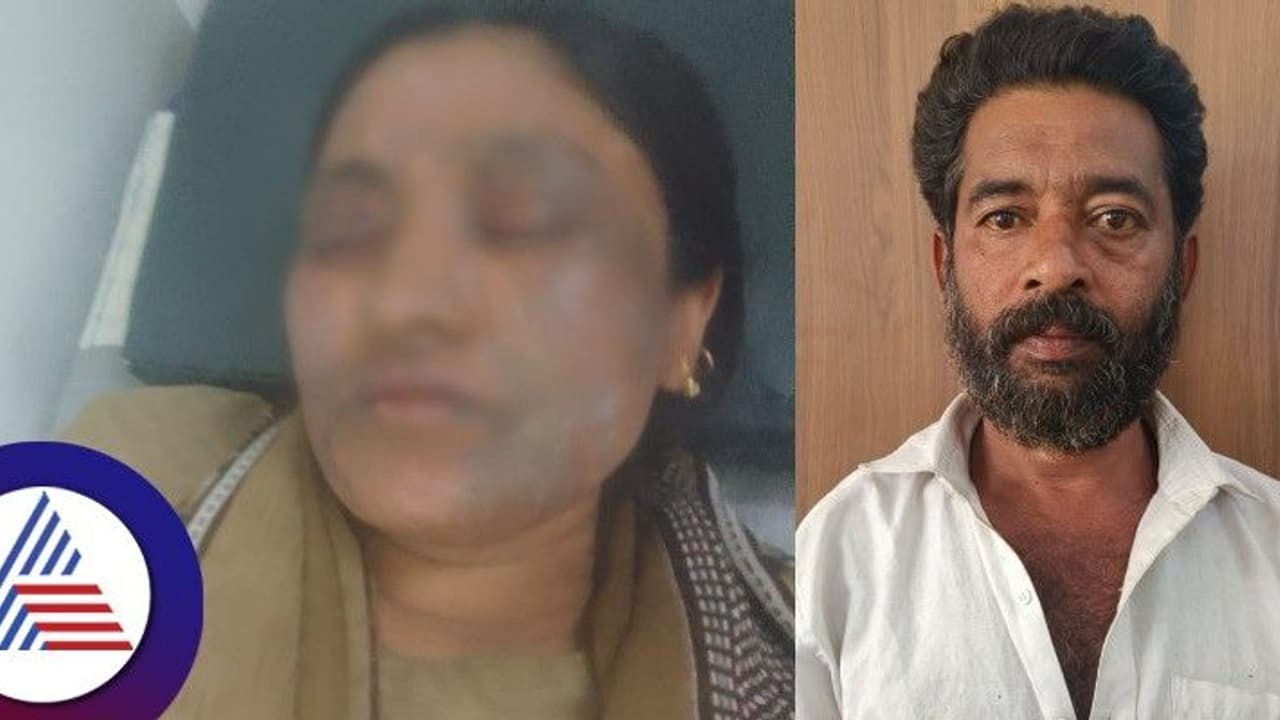 ಅಡುಗೆ ಮಾಡಲು ಸಾಮಾನು ತರುವಂತೆ ಹೇಳಿದ್ದಕ್ಕೇ ಪತ್ನಿಯ ಮೇಲೆ ಆಸಿಡ್ ಎರಚಿ ಪರಾರಿಯಾದ ಕಿರಾತಕ ಗಂಡ! ಅಡುಗೆ ಮಾಡಲು ಸಾಮಾನು ತರುವಂತೆ ಹೇಳಿದ್ದಕ್ಕೇ ಪತ್ನಿಯ ಮೇಲೆ ಆಸಿಡ್ ಎರಚಿ ಪರಾರಿಯಾದ ಕಿರಾತಕ ಗಂಡ!