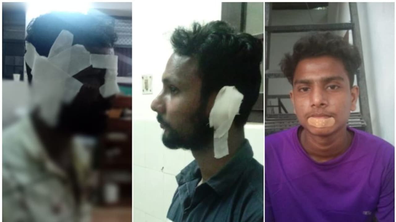 'ചങ്ങായീസ് തട്ടുകട'യിൽ യുവാക്കളുടെ അക്രമം; ഉടമയുടെ തല തല്ലിപ്പൊളിച്ചു, ജീവനക്കാർക്കും മർദ്ദനം 'ചങ്ങായീസ് തട്ടുകട'യിൽ യുവാക്കളുടെ അക്രമം; ഉടമയുടെ തല തല്ലിപ്പൊളിച്ചു, ജീവനക്കാർക്കും മർദ്ദനം