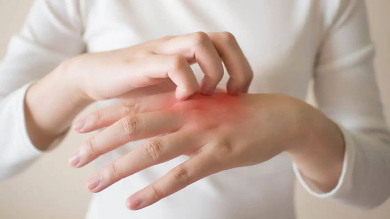 Health Tips: എക്സീമയുടെ ഈ ലക്ഷണങ്ങളെ അറിയാതെ പോകരുത്... 