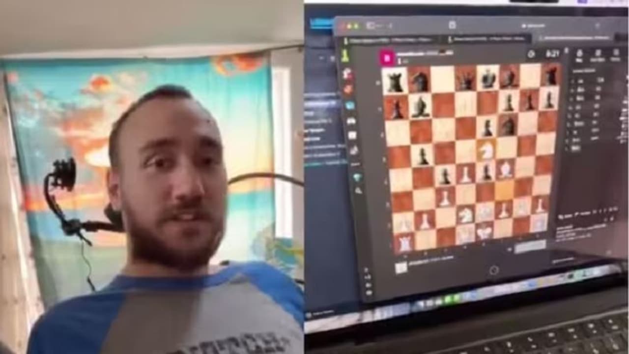 Neuralink: ಮೆದುಳಿಗೆ ಚಿಪ್‌ ಹಾಕಿದ ಬಳಿಕ ತಲೇಲಿ ಯೋಚಿಸಿ ಕಂಪ್ಯೂಟರಲ್ಲಿ ಚೆಸ್‌ ಆಡಿದ!