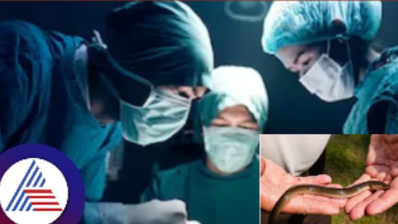 ಗುದದ ಮೂಲಕ ಹೊಟ್ಟೆಗ್ಹೋದ ಹಾವು, ಜೀವಂತವಾಗಿ ಹೊರ ತೆಗೆದ ಡಾಕ್ಟರ್ಸ್ !