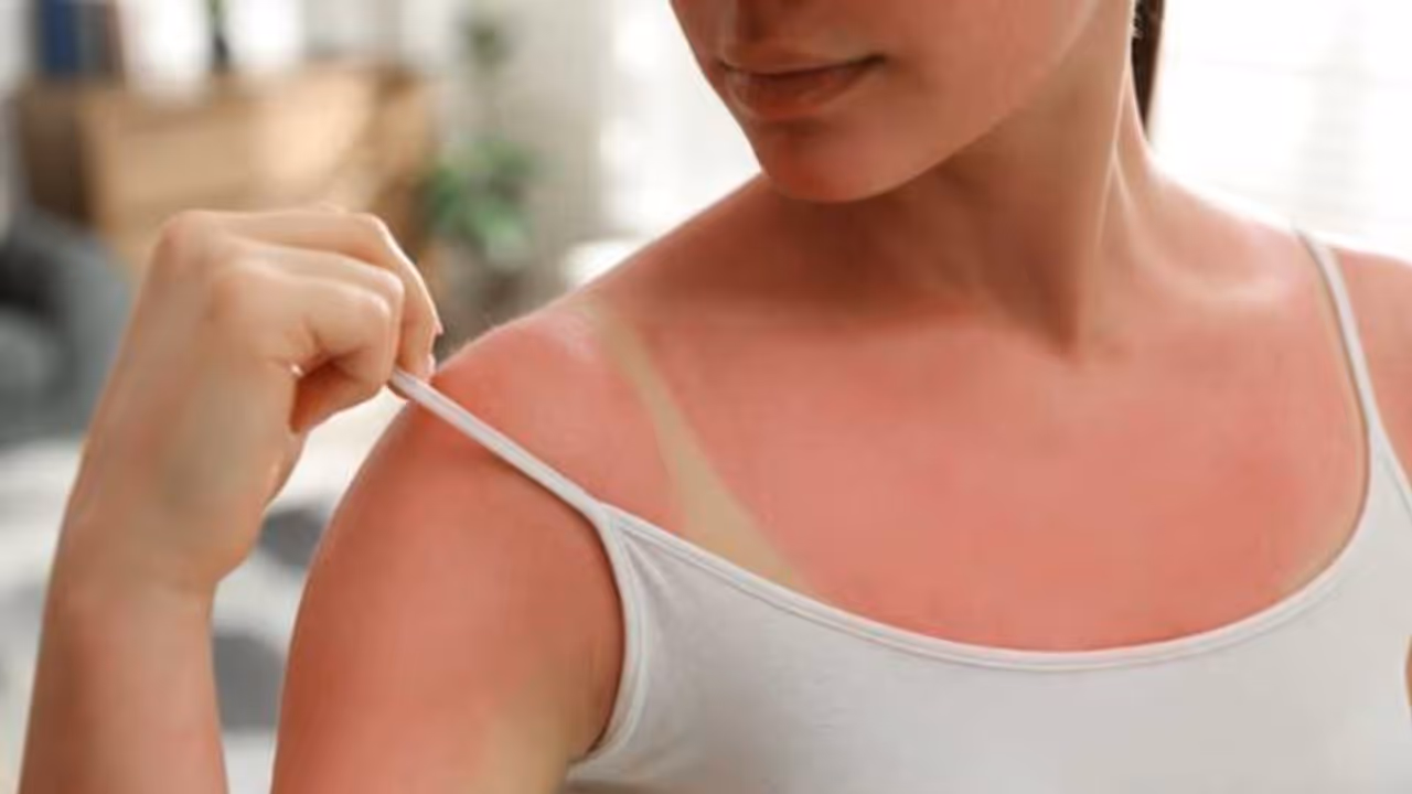 വെയിലേറ്റ് കരുവാളിച്ചോ? സൺ ടാൻ അകറ്റാൻ പരീക്ഷിക്കാം ഈ പാക്കുകള്... വെയിലേറ്റ് കരുവാളിച്ചോ? സൺ ടാൻ അകറ്റാൻ പരീക്ഷിക്കാം ഈ പാക്കുകള്...