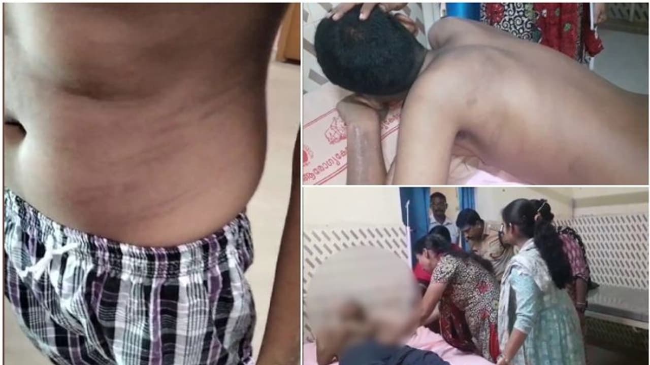 'ഭിന്നശേഷിക്കാരനായ 16കാരന് ക്രൂര മര്ദനം'; പ്രിന്സിപ്പളിനെതിരെയും ജീവനക്കാരിക്കെതിരെയും കേസെടുത്ത് പൊലീസ് 'ഭിന്നശേഷിക്കാരനായ 16കാരന് ക്രൂര മര്ദനം'; പ്രിന്സിപ്പളിനെതിരെയും ജീവനക്കാരിക്കെതിരെയും കേസെടുത്ത് പൊലീസ്