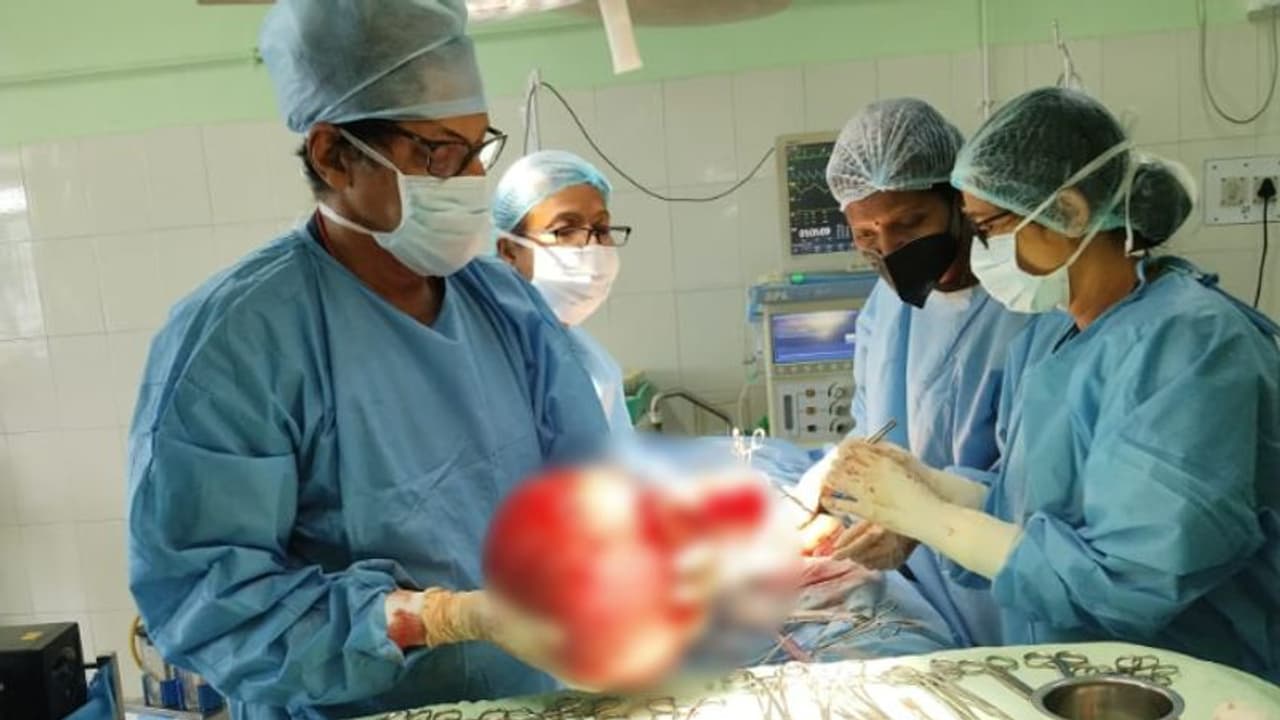 Kerala: Doctors successfully remove 4.5 kg of uterine tumour from 40 year old woman in Kottayam Kerala: Doctors successfully remove 4.5 kg of uterine tumour from 40 year old woman in Kottayam