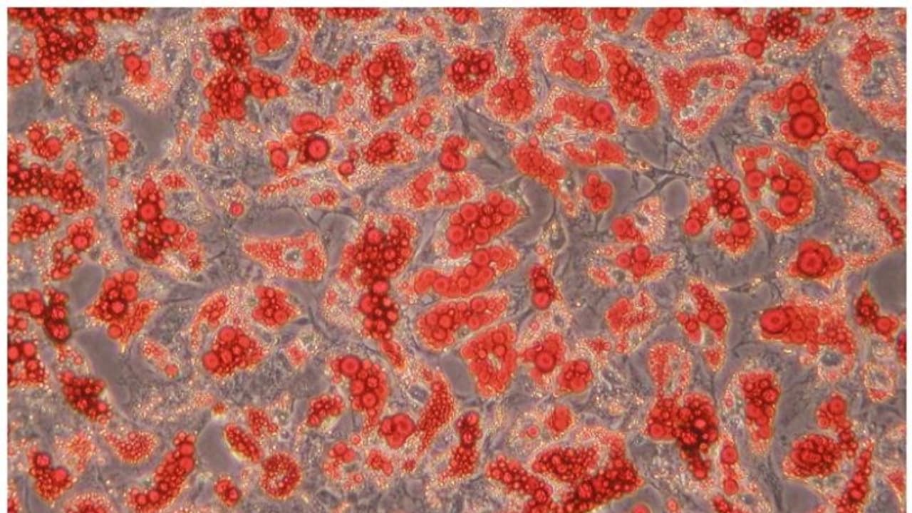 എന്താണ് ബ്രൗൺ ഫാറ്റ് ? ആരോഗ്യകരമാണോ? അറിയേണ്ടതെല്ലാം