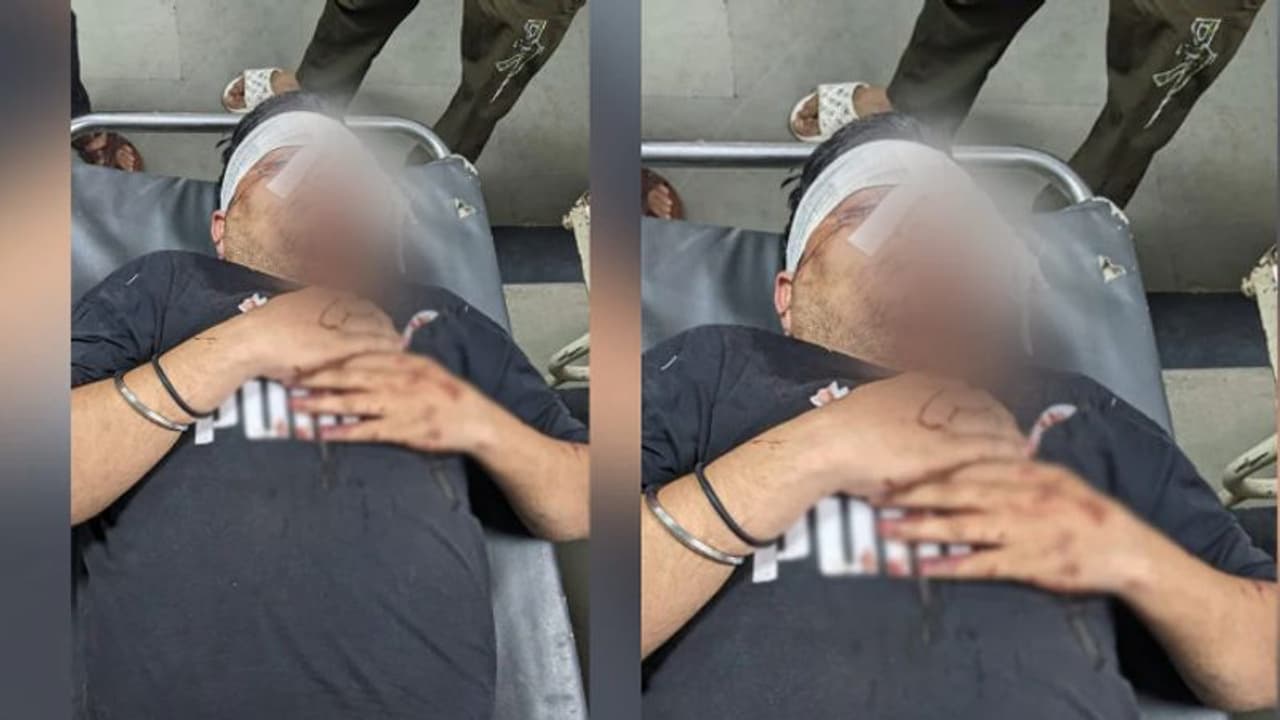 20 രൂപ പാസിനെ ചൊല്ലി തർക്കം, യുവാവിന്‍റെ മുഖത്ത് കമ്പി വടികൊണ്ട് അടിച്ച് ബൗൺസർ, ഒരു കണ്ണിന്‍റെ കാഴ്ച പോയി