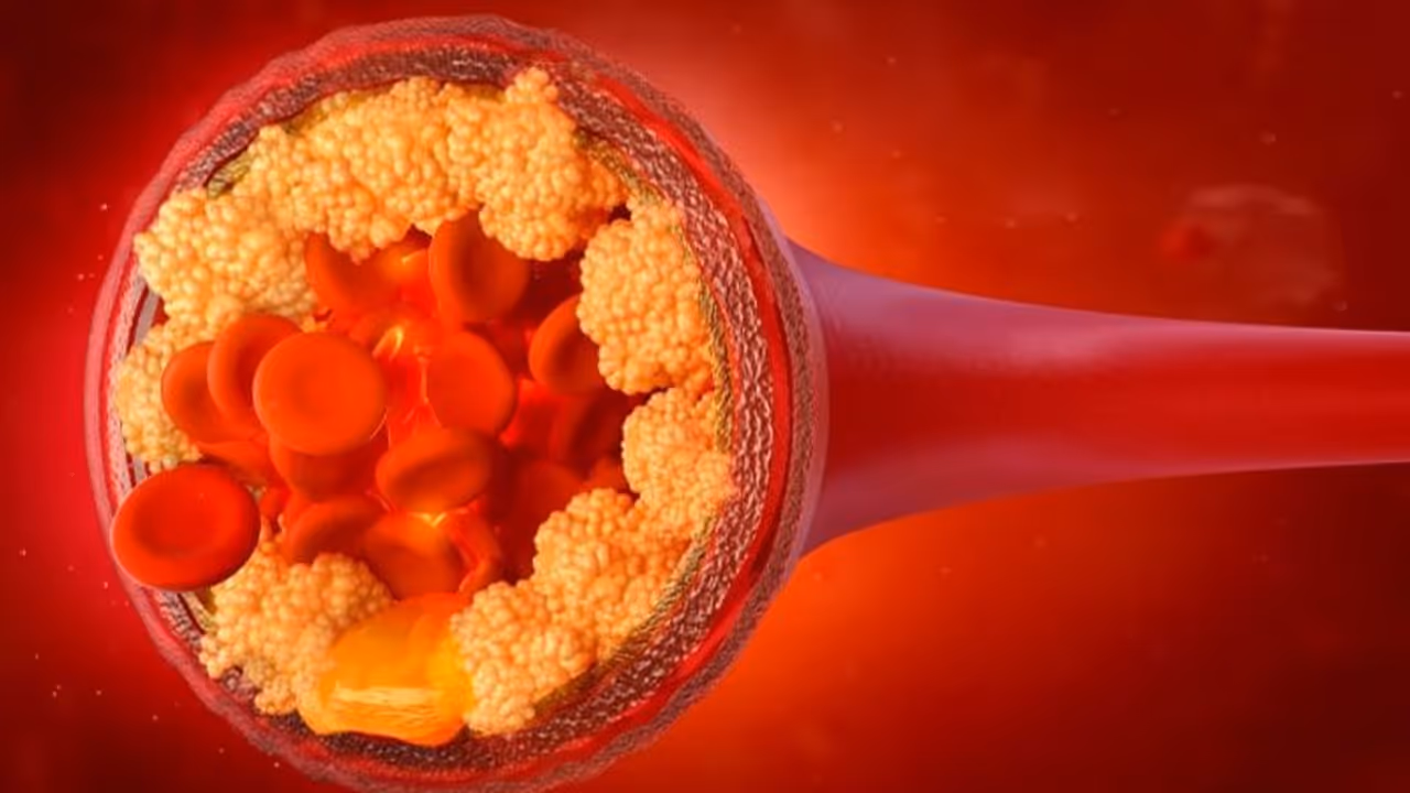 കൊളസ്ട്രോള് കുറയ്ക്കണോ? ഡയറ്റില് ഉള്പ്പെടുത്താം ഈ സുഗന്ധവ്യജ്ഞനങ്ങൾ... കൊളസ്ട്രോള് കുറയ്ക്കണോ? ഡയറ്റില് ഉള്പ്പെടുത്താം ഈ സുഗന്ധവ്യജ്ഞനങ്ങൾ...