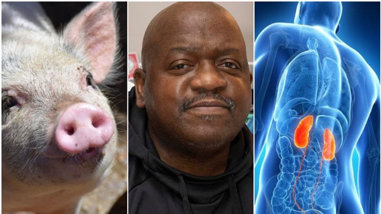 ഡയാലിസിസ് ചെയ്യാത്ത രണ്ടാഴ്ച; ലോകം കാത്തിരുന്ന സന്തോഷ വാർത്ത, പന്നിവൃക്ക സ്വീകരിച്ച റിച്ചാർഡ് ആശുപത്രി വിട്ടു ഡയാലിസിസ് ചെയ്യാത്ത രണ്ടാഴ്ച; ലോകം കാത്തിരുന്ന സന്തോഷ വാർത്ത, പന്നിവൃക്ക സ്വീകരിച്ച റിച്ചാർഡ് ആശുപത്രി വിട്ടു