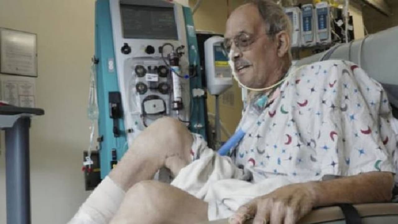 Shoking! इंसान में लगाया गया था सुअर का दिल, उठ कर चलने लगा पेशेंट, फिर इस कारण से आ गई थी आफत