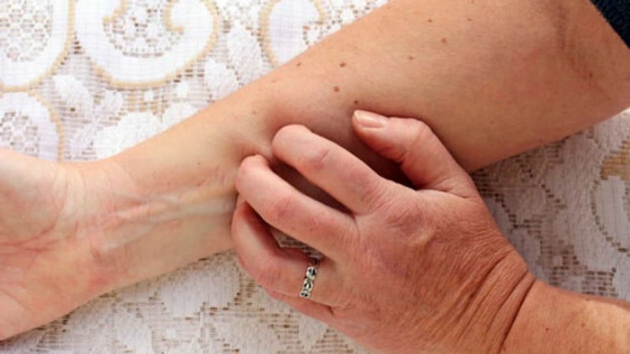 ഇതിലേതെങ്കിലും ലക്ഷണങ്ങൾ നിങ്ങൾക്കുണ്ടോ? അവഗണിക്കരുത്, ശരീരത്തിലെ ഈ മാറ്റങ്ങള് വൃക്കരോഗത്തിന്റെയാകാം... ഇതിലേതെങ്കിലും ലക്ഷണങ്ങൾ നിങ്ങൾക്കുണ്ടോ? അവഗണിക്കരുത്, ശരീരത്തിലെ ഈ മാറ്റങ്ങള് വൃക്കരോഗത്തിന്റെയാകാം...