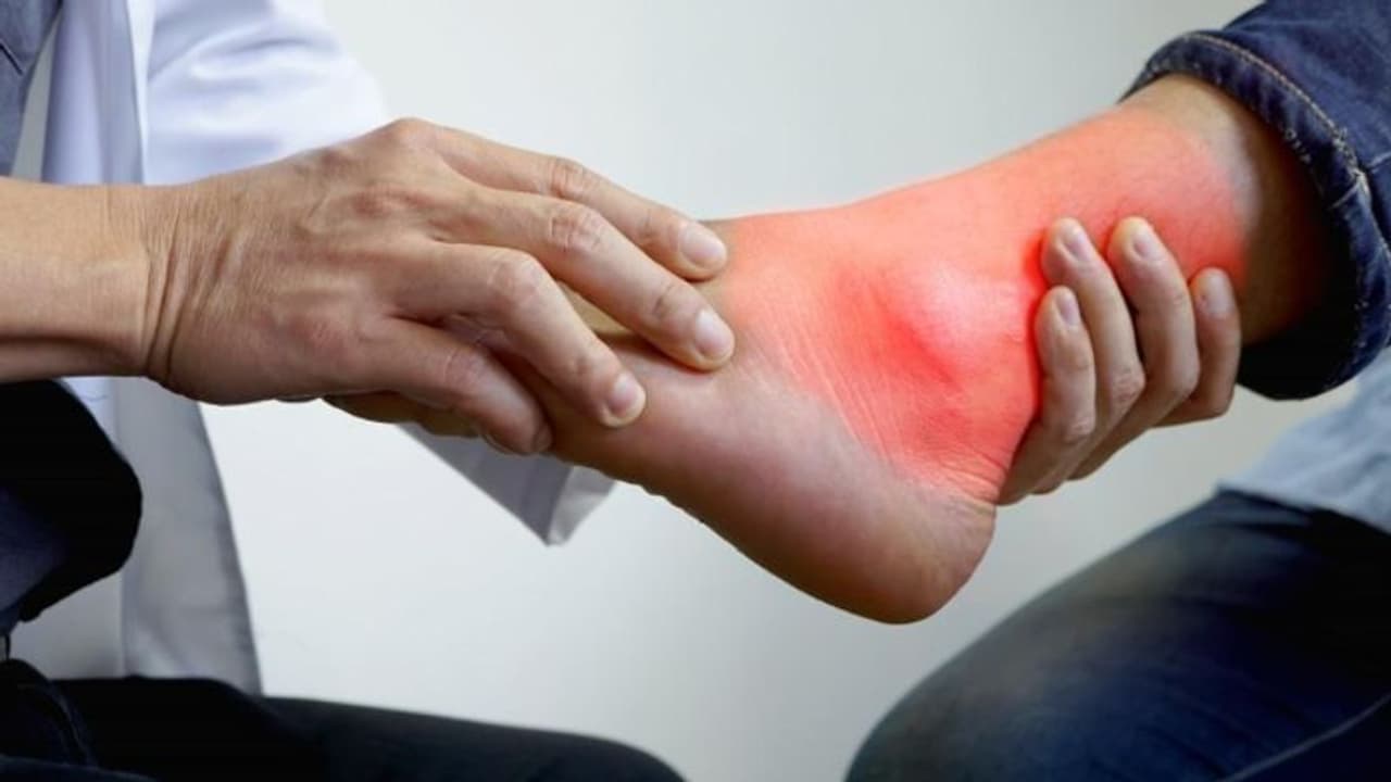 യൂറിക് ആസിഡ് കൂടുന്നുണ്ടോ? ഡയറ്റില് ഉള്പ്പെടുത്താം ഈ സുഗന്ധവ്യജ്ഞനങ്ങൾ... യൂറിക് ആസിഡ് കൂടുന്നുണ്ടോ? ഡയറ്റില് ഉള്പ്പെടുത്താം ഈ സുഗന്ധവ്യജ്ഞനങ്ങൾ...