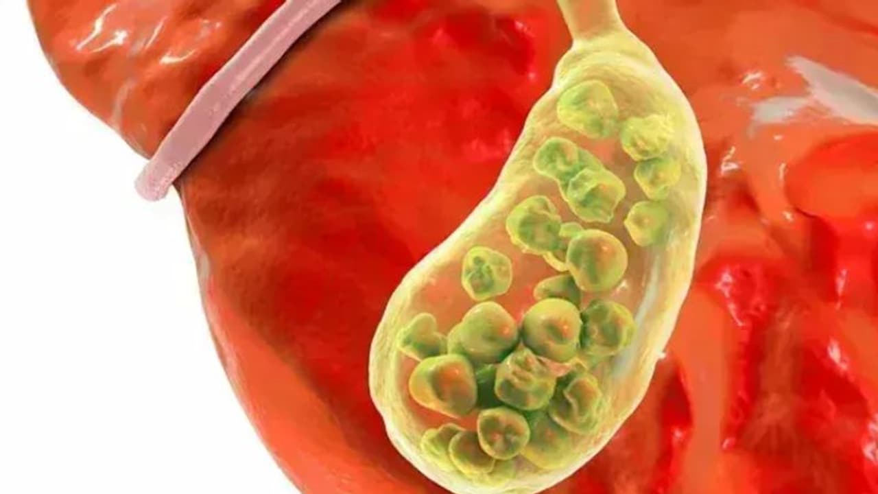 കൊളസ്ട്രോള് കുറയ്ക്കാന് വീട്ടില് ചെയ്യാവുന്ന കാര്യങ്ങള്... കൊളസ്ട്രോള് കുറയ്ക്കാന് വീട്ടില് ചെയ്യാവുന്ന കാര്യങ്ങള്...