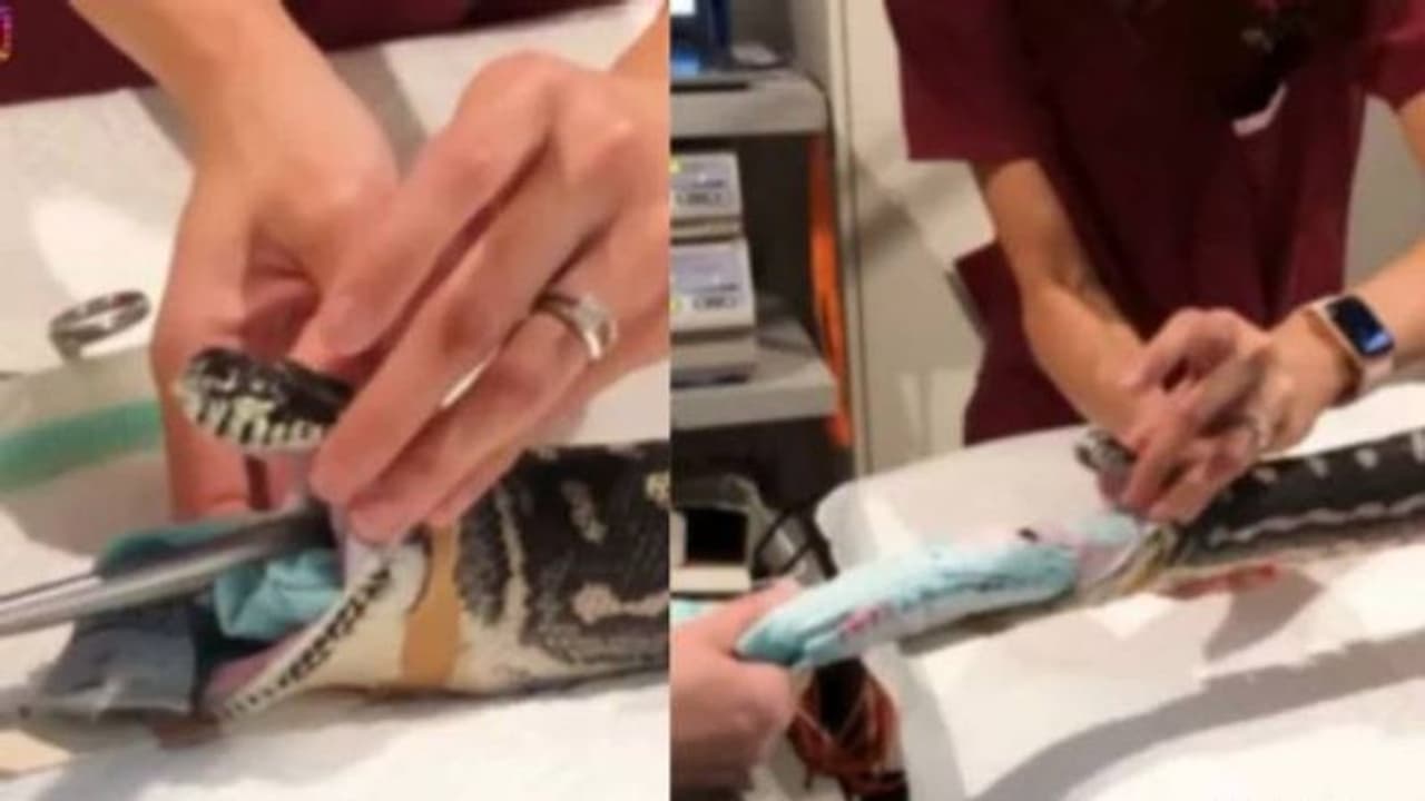 ടവ്വൽ അപ്പാടെ വിഴുങ്ങി പാമ്പ്, ആശുപത്രിയിലെത്തിച്ച് ഓപ്പറേഷൻ, മുഴുവനും വലിച്ച് പുറത്തെടുക്കുന്ന വീഡിയോ വൈറൽ ടവ്വൽ അപ്പാടെ വിഴുങ്ങി പാമ്പ്, ആശുപത്രിയിലെത്തിച്ച് ഓപ്പറേഷൻ, മുഴുവനും വലിച്ച് പുറത്തെടുക്കുന്ന വീഡിയോ വൈറൽ