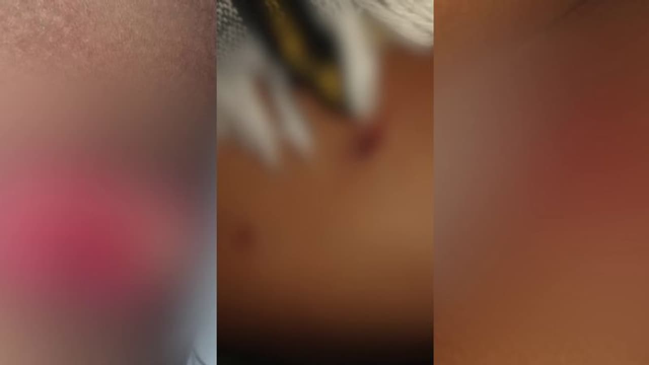 7വയസുകാരനെ തെരുവുനായ്ക്കൾ കൂട്ടം ചേര്ന്ന് ആക്രമിച്ചു, ഗുരുതര പരിക്ക്; ദാരുണ സംഭവം പാലക്കാട് 7വയസുകാരനെ തെരുവുനായ്ക്കൾ കൂട്ടം ചേര്ന്ന് ആക്രമിച്ചു, ഗുരുതര പരിക്ക്; ദാരുണ സംഭവം പാലക്കാട്