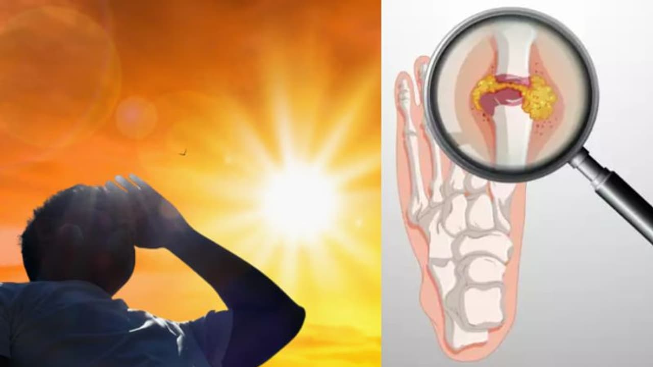 ചൂട് കൂടുമ്പോൾ ശരീരത്തില് യൂറിക്ക് ആസിഡ് കൂടാം; അറിയാം ഈ ലക്ഷണങ്ങളും ശ്രദ്ധിക്കേണ്ട കാര്യങ്ങളും... ചൂട് കൂടുമ്പോൾ ശരീരത്തില് യൂറിക്ക് ആസിഡ് കൂടാം; അറിയാം ഈ ലക്ഷണങ്ങളും ശ്രദ്ധിക്കേണ്ട കാര്യങ്ങളും...