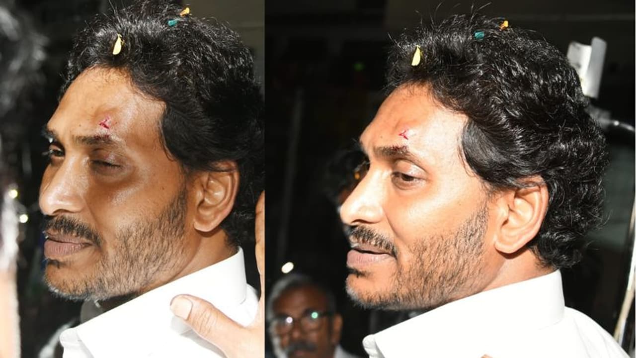 ಚುನಾವಣಾ ಪ್ರಚಾರದ ವೇಳೆ ಕಲ್ಲು ತೂರಾಟ, ಸಿಎಂ ಜಗನ್ ಮೋಹನ್ ರೆಡ್ಡಿಗೆ ಗಾಯ!