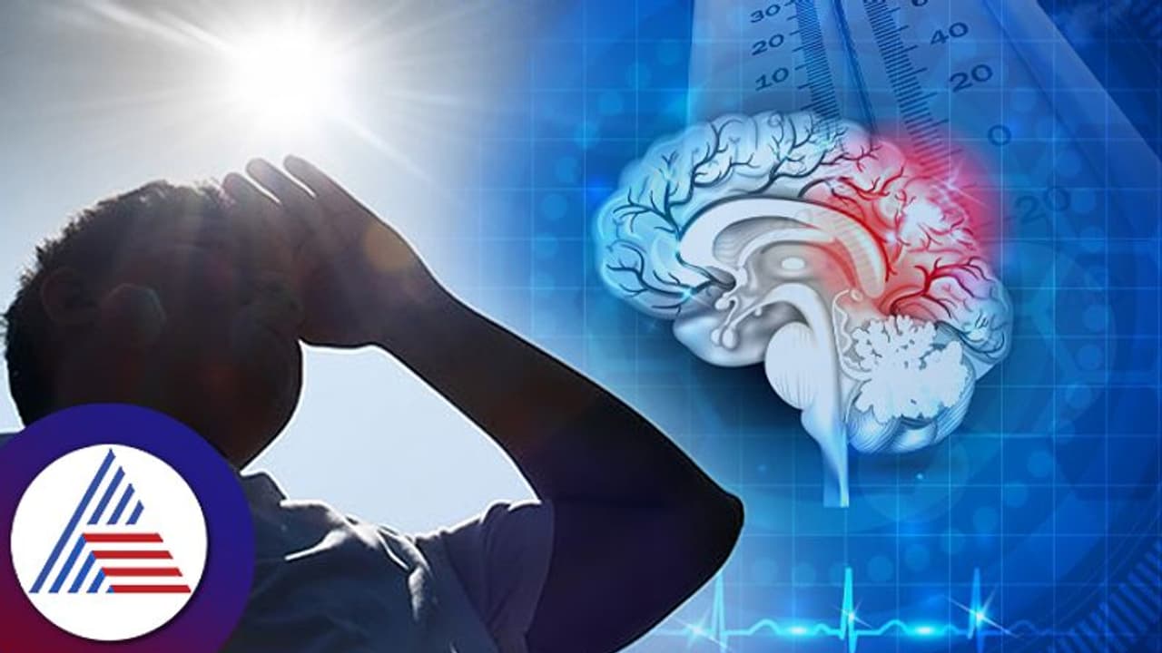 ಈ ಬೇಸಿಗೆ ಸಾಕಪ್ಪಾ ಸಾಕು; ಬ್ರೇನ್‌ ಸ್ಟ್ರೋಕ್‌ ಬಗ್ಗೆ ಹುಷಾರಾಗಿರಿ