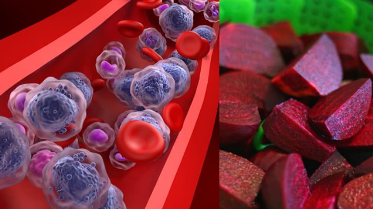 അനീമിയ അഥവാ വിളര്‍ച്ചയെ തടയാന്‍ കഴിക്കാം ഈ ആറ് ഭക്ഷണങ്ങള്‍... 