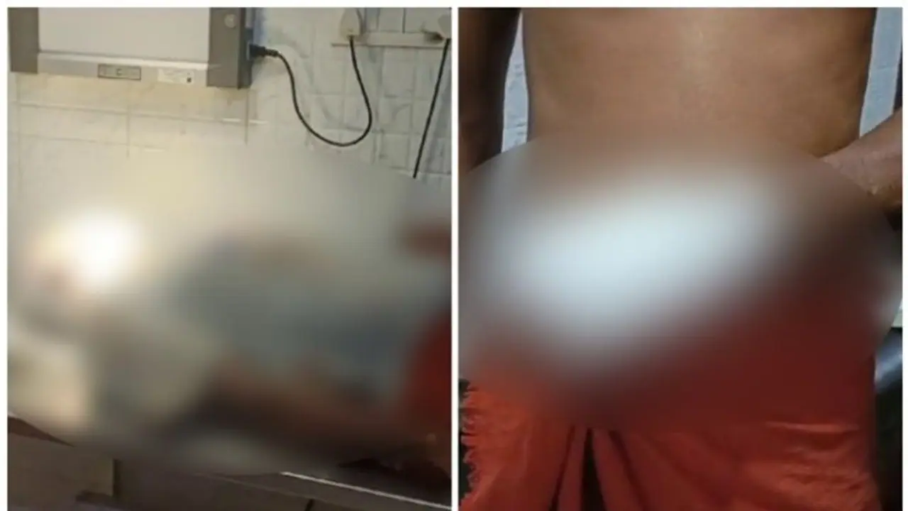 വിവാഹാലോചനയിൽ നിന്ന് പിന്മാറി, യുവതിയെ വെട്ടിപ്പരിക്കേൽപിച്ചു; ആക്രമണത്തിൽ 5 പേർക്ക് വെട്ടേറ്റു വിവാഹാലോചനയിൽ നിന്ന് പിന്മാറി, യുവതിയെ വെട്ടിപ്പരിക്കേൽപിച്ചു; ആക്രമണത്തിൽ 5 പേർക്ക് വെട്ടേറ്റു