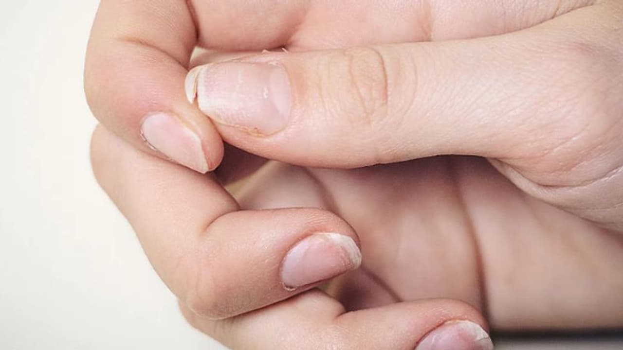 കാത്സ്യത്തിന്റെ കുറവുണ്ടോ? ശരീരം കാണിക്കുന്ന ഈ സൂചനകളെ അവഗണിക്കരുത്... കാത്സ്യത്തിന്റെ കുറവുണ്ടോ? ശരീരം കാണിക്കുന്ന ഈ സൂചനകളെ അവഗണിക്കരുത്...