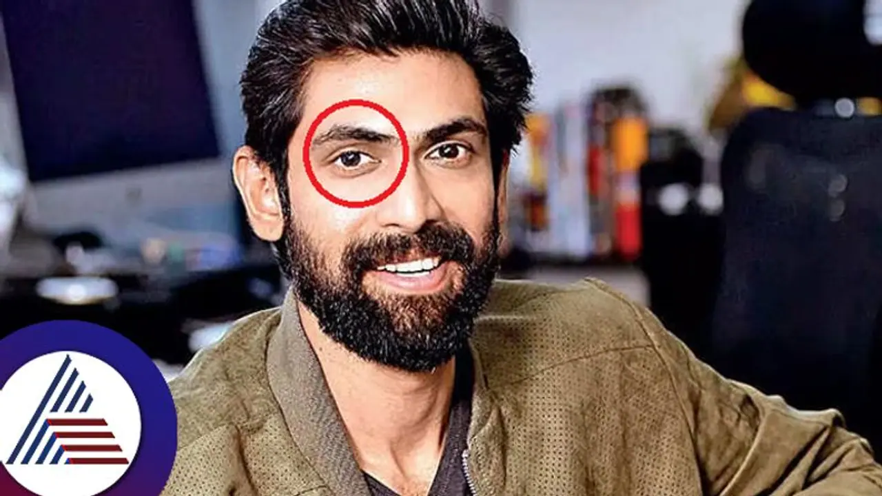 ತಾಯಿಯಿಂದ ಕಿಡ್ನಿ ದಾನ, ಬೇರೆಯವರಿಗೆ ಕೊಟ್ಟರು ದೃಷ್ಟಿದಾನ: ಇದು ರಾಣಾ ದುಗ್ಗುಬಾಟಿ ಸೀಕ್ರೇಟ್​!