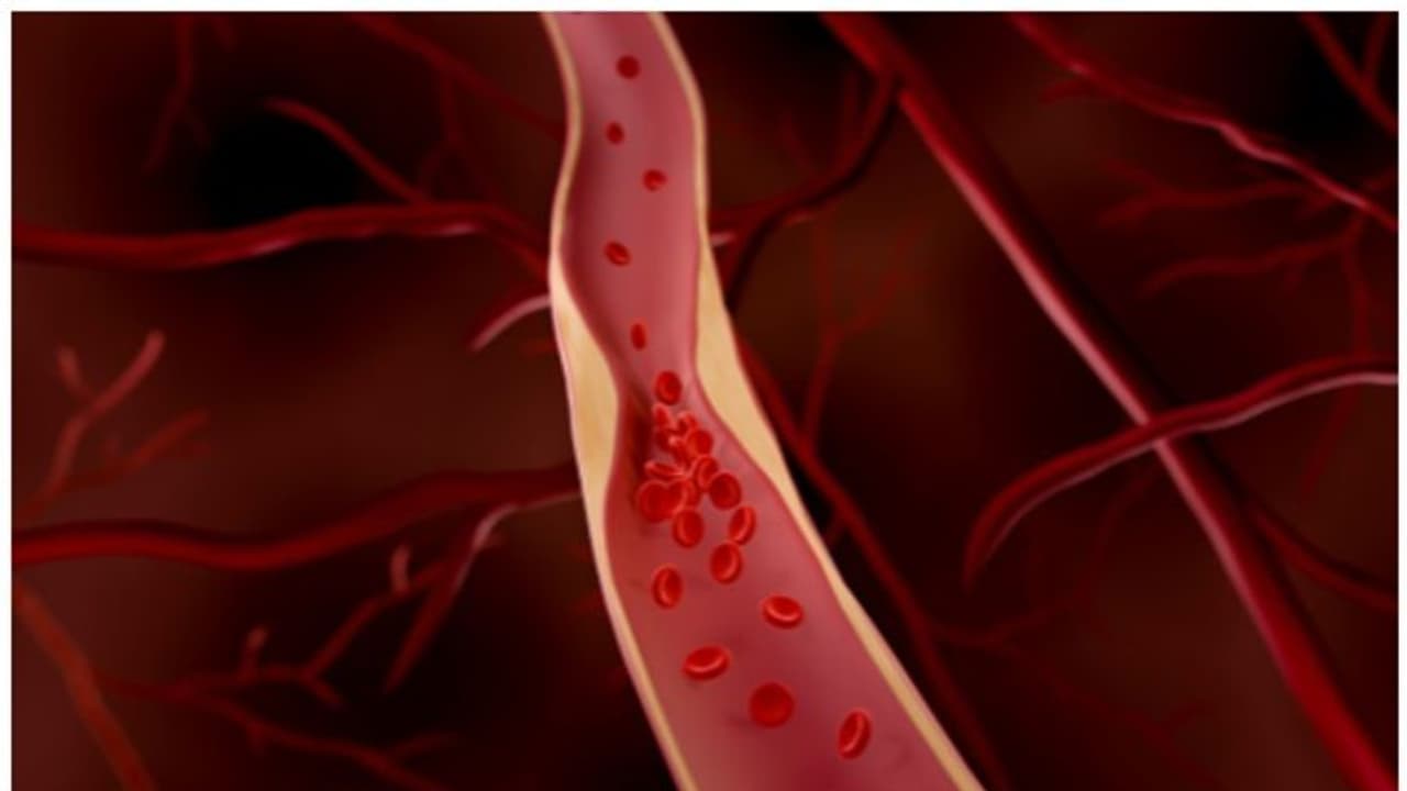 ഹൃദയത്തിൽ ബ്ലോക്ക് ; ശരീരം കാണിക്കുന്ന പ്രധാനപ്പെട്ട ചില ലക്ഷണങ്ങൾ ഹൃദയത്തിൽ ബ്ലോക്ക് ; ശരീരം കാണിക്കുന്ന പ്രധാനപ്പെട്ട ചില ലക്ഷണങ്ങൾ