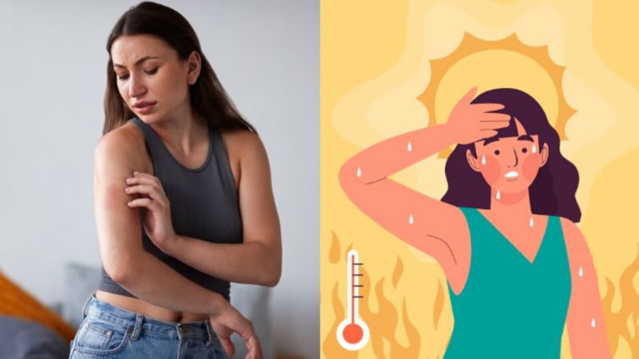 Heat rash to dehydration: BEWARE of these 6 summer skin problems 