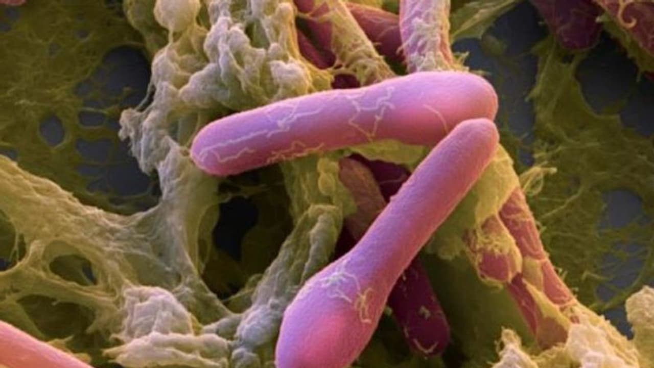  ഭക്ഷ്യ വിഷബാധയേറ്റ് 28 പേർ തീവ്രപരിചരണ വിഭാഗത്തിൽ, കാരണം ക്ലോസ്ട്രീഡിയം ബോട്ടുലിനം ബാക്ടീരിയ, സംഭവം റിയാദിൽ