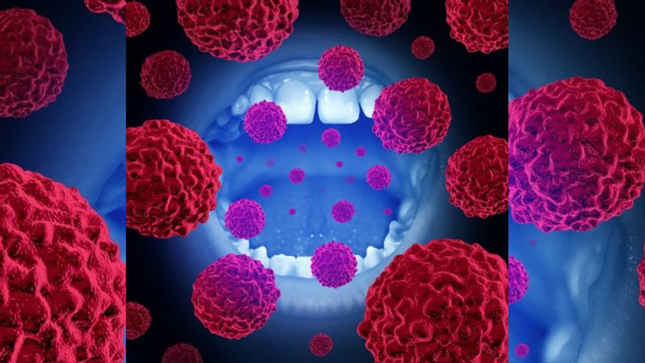 വായിലെ ക്യാന്‍സര്‍; തുടക്കത്തിലെ കാണിക്കുന്ന ഈ ലക്ഷണങ്ങളെ അവഗണിക്കരുതേ...
