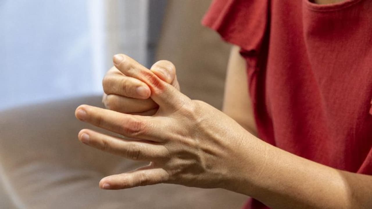 യൂറിക് ആസിഡ് കൂടുന്നുണ്ടോ? ഡയറ്റില് ഉള്പ്പെടുത്താം ഈ നട്സും സീഡ്സും യൂറിക് ആസിഡ് കൂടുന്നുണ്ടോ? ഡയറ്റില് ഉള്പ്പെടുത്താം ഈ നട്സും സീഡ്സും