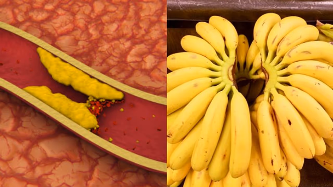 ഉയര്ന്ന കൊളസ്ട്രോള് കുറയ്ക്കാന് ഡയറ്റില് ഉള്പ്പെടുത്താം ഈ എട്ട് പഴങ്ങള് ഉയര്ന്ന കൊളസ്ട്രോള് കുറയ്ക്കാന് ഡയറ്റില് ഉള്പ്പെടുത്താം ഈ എട്ട് പഴങ്ങള്