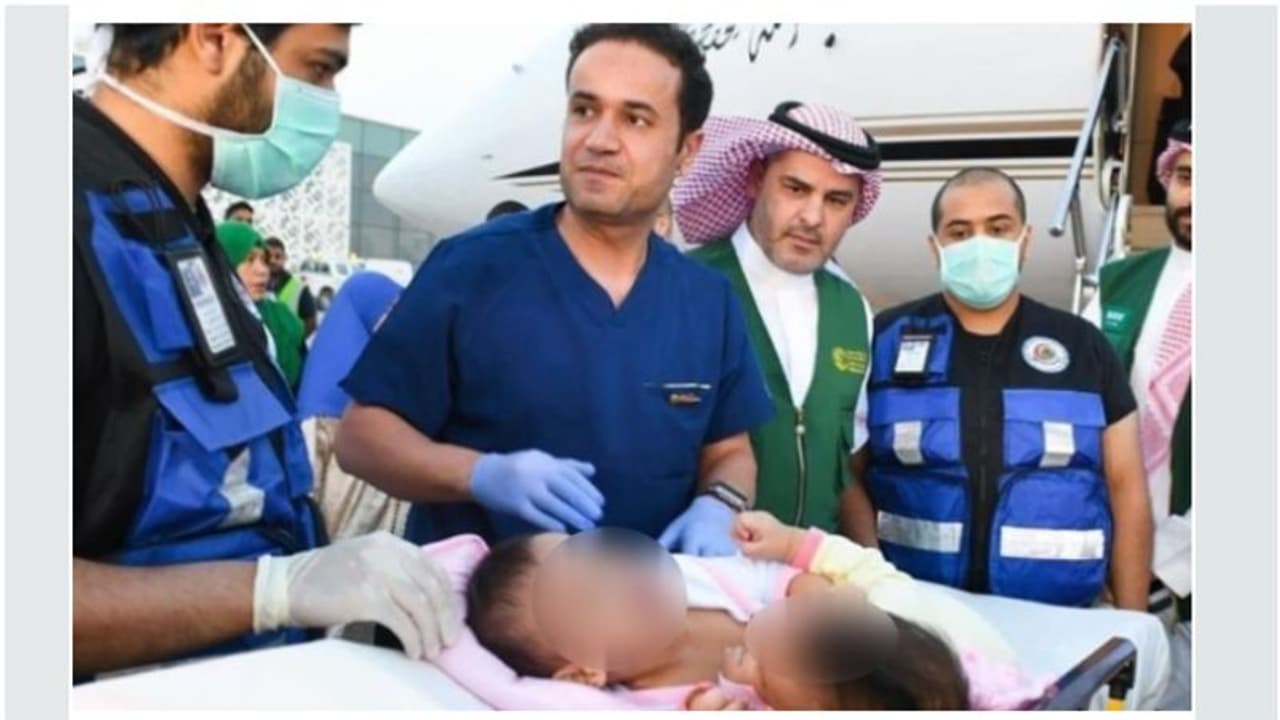 വേര്പെടുത്തൽ ശസ്ത്രക്രിയ; സയാമീസ് ഇരട്ടകളായ അകീസയേയും ആഇശയേയും റിയാദിലെത്തിച്ചു വേര്പെടുത്തൽ ശസ്ത്രക്രിയ; സയാമീസ് ഇരട്ടകളായ അകീസയേയും ആഇശയേയും റിയാദിലെത്തിച്ചു