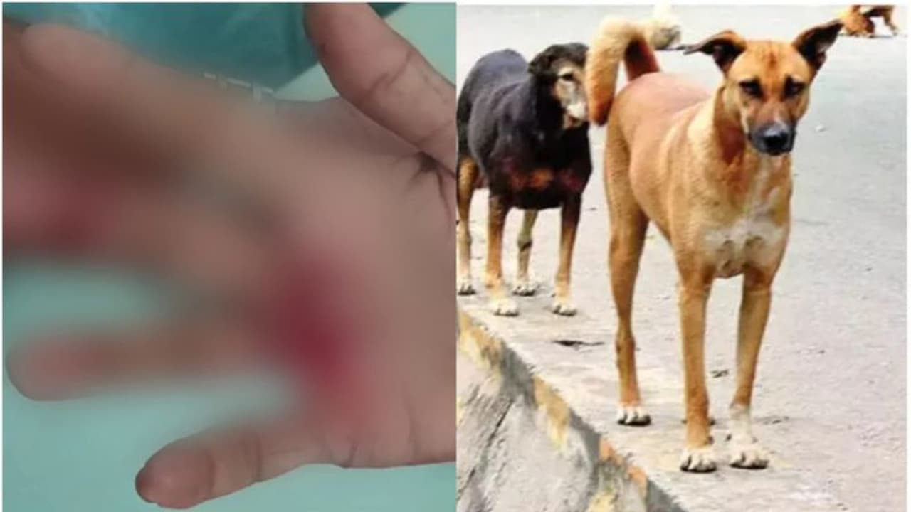 നാദാപുരത്ത് തെരുവുനായ ആക്രമണത്തിൽ രണ്ട് വയോധികർക്ക് പരിക്ക്; പ്രദേശത്ത് 3 മാസത്തിനിടെ കടിയേറ്റത് 25 പേർക്ക്