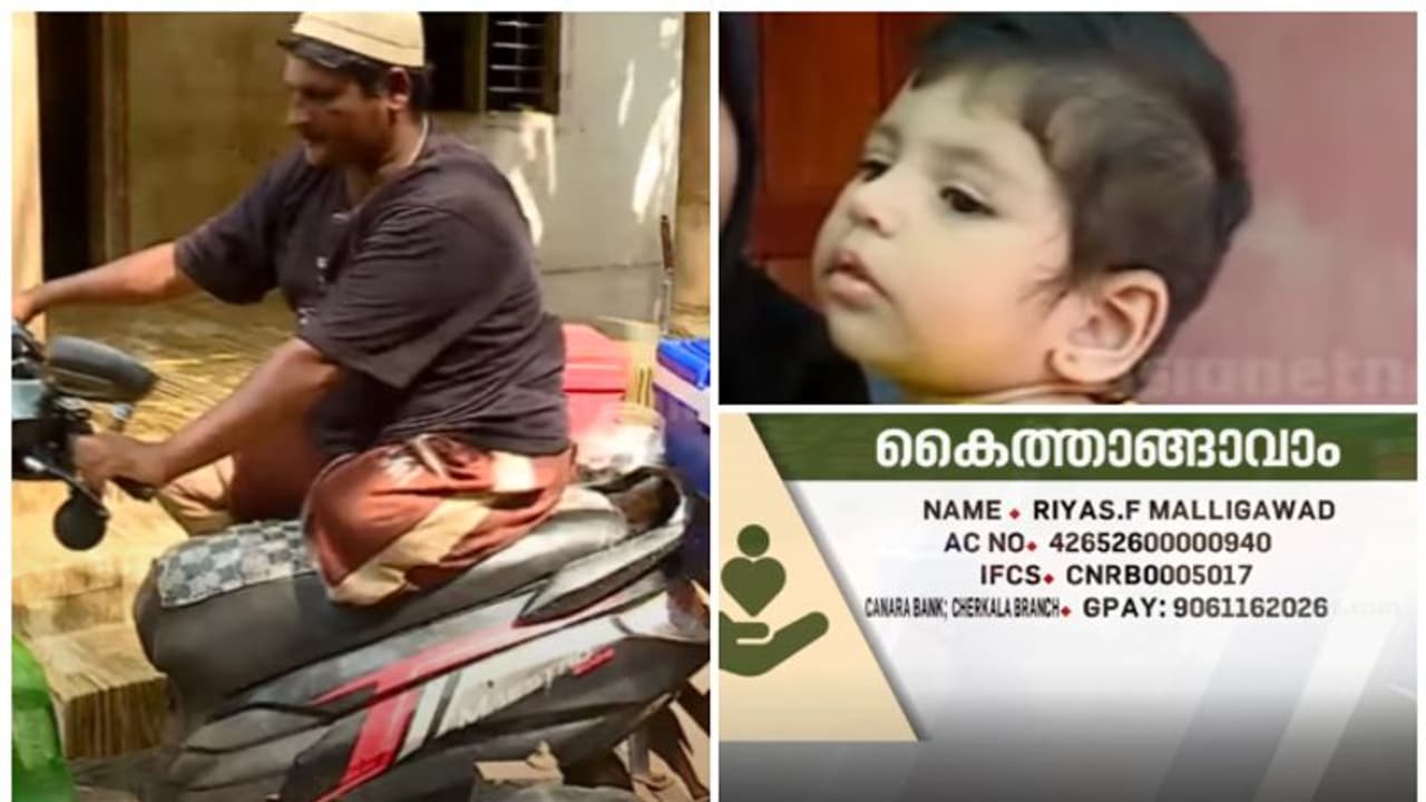 10 മാസം പ്രായമുള്ള കുഞ്ഞിന് തലച്ചോറിൽ നീർക്കെട്ട്; ചികിത്സയ്ക്ക് പണമില്ലാതെ ഇരുകാലുകളും മുറിച്ചുമാറ്റിയ യുവാവ്