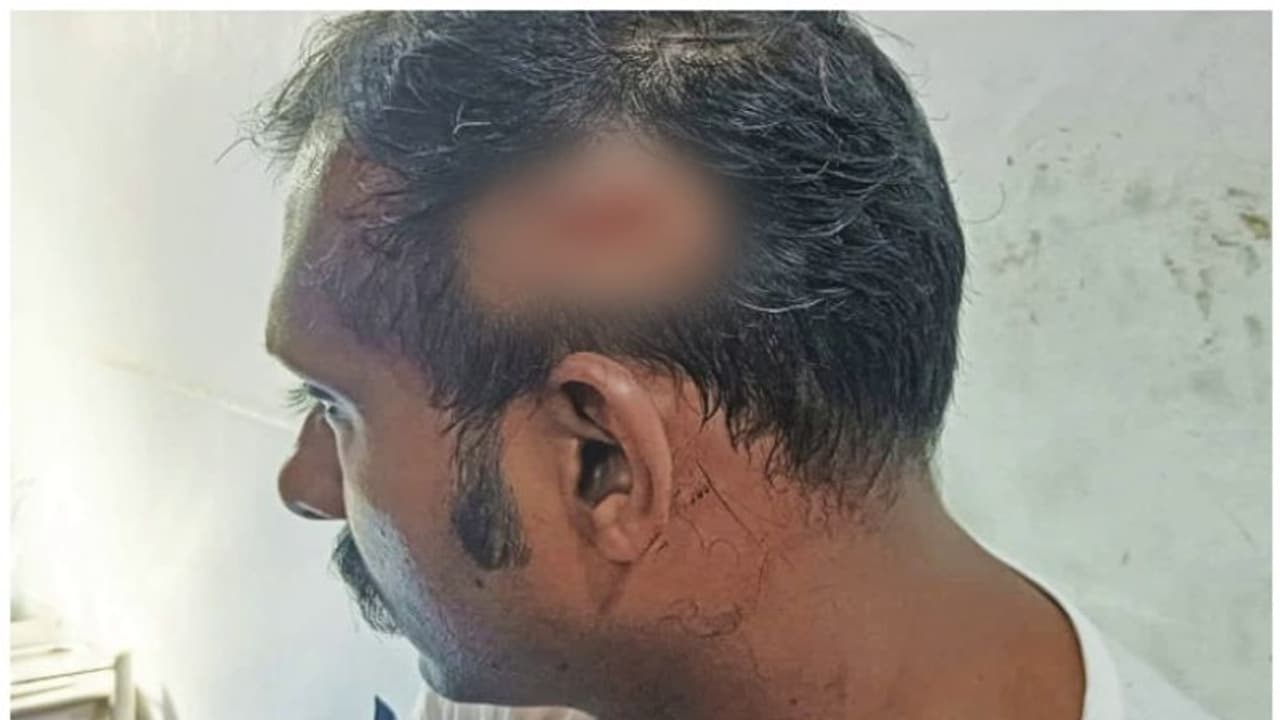 കഴക്കൂട്ടത്ത് ഉത്സവത്തിനിടെ സംഘർഷം; പൊലീസുകാരനെ കമ്പി കൊണ്ട് തലക്കടിച്ചു; 6 പേർ കസ്റ്റഡിയിൽ കഴക്കൂട്ടത്ത് ഉത്സവത്തിനിടെ സംഘർഷം; പൊലീസുകാരനെ കമ്പി കൊണ്ട് തലക്കടിച്ചു; 6 പേർ കസ്റ്റഡിയിൽ