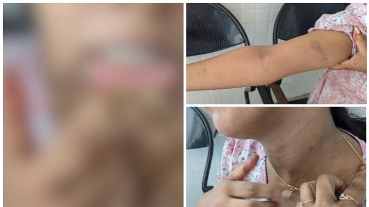 നവവധുവിന് ക്രൂരമർദനമേറ്റ സംഭവം: മുഖ്യമന്ത്രിക്ക് പരാതി നൽകാൻ കുടുംബം; വധശ്രമം ഉൾപ്പെടെ ചുമത്തണമെന്ന് ആവശ്യം നവവധുവിന് ക്രൂരമർദനമേറ്റ സംഭവം: മുഖ്യമന്ത്രിക്ക് പരാതി നൽകാൻ കുടുംബം; വധശ്രമം ഉൾപ്പെടെ ചുമത്തണമെന്ന് ആവശ്യം