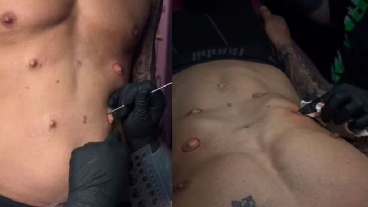 ಅಬ್ಬಬ್ಬಾ..ಏನೆಲ್ಲಾ ಮಾಡ್ತಾರಪ್ಪಾ, ಸರ್ಜರಿ ಮೂಲಕ ದೇಹದ ಮೇಲೆ ನಾಲ್ಕು ನಿಪ್ಪಲ್ ಸೇರಿಸಿಕೊಂಡ ವ್ಯಕ್ತಿ! ಅಬ್ಬಬ್ಬಾ..ಏನೆಲ್ಲಾ ಮಾಡ್ತಾರಪ್ಪಾ, ಸರ್ಜರಿ ಮೂಲಕ ದೇಹದ ಮೇಲೆ ನಾಲ್ಕು ನಿಪ್ಪಲ್ ಸೇರಿಸಿಕೊಂಡ ವ್ಯಕ್ತಿ!