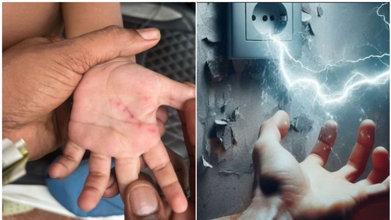 'ബൾബുകളും, ട്യൂബുകളും പൊട്ടിത്തെറിച്ചു, ഒന്നര വയസുകാരന് പരുക്ക്'; വീട്ടിൽ അമിതമായ വൈദ്യുത പ്രവാഹമെന്ന് പരാതി