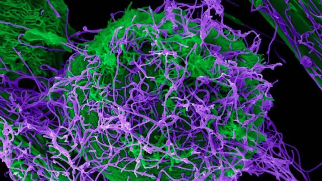 ಚೀನಾ ಲ್ಯಾಬ್‌ನಲ್ಲಿ ಮತ್ತೊಂದು ಮಾರಣಾಂತಿಕ ವೈರಸ್ ವಿನ್ಯಾಸಗೊಳಿಸಿದ ವಿಜ್ಞಾನಿಗಳು!