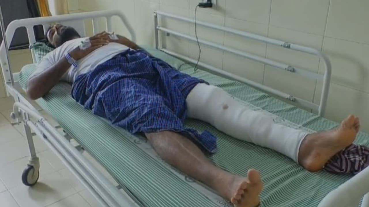 ബൈക്കിലേക്ക് കയറവെ റോഡരികിലെ പൊട്ടിയ സ്ലാബില് കുടുങ്ങി യുവാവിന്റെ കാലൊടിഞ്ഞു ബൈക്കിലേക്ക് കയറവെ റോഡരികിലെ പൊട്ടിയ സ്ലാബില് കുടുങ്ങി യുവാവിന്റെ കാലൊടിഞ്ഞു