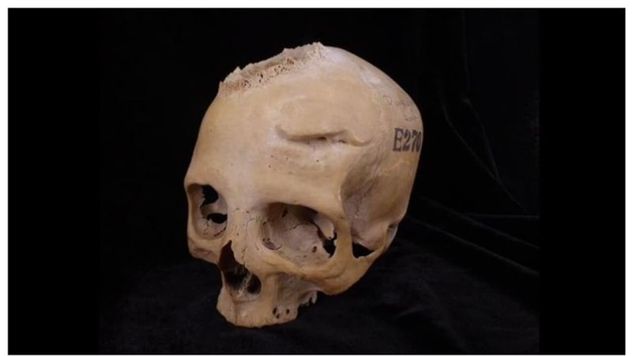 4,700 വർഷങ്ങൾക്ക് മുമ്പ് പുരാതന ഈജിപ്തുകാർ കാൻസർ ശസ്ത്രക്രിയയ്ക്ക് ശ്രമിച്ചെന്ന് പഠനം 4,700 വർഷങ്ങൾക്ക് മുമ്പ് പുരാതന ഈജിപ്തുകാർ കാൻസർ ശസ്ത്രക്രിയയ്ക്ക് ശ്രമിച്ചെന്ന് പഠനം